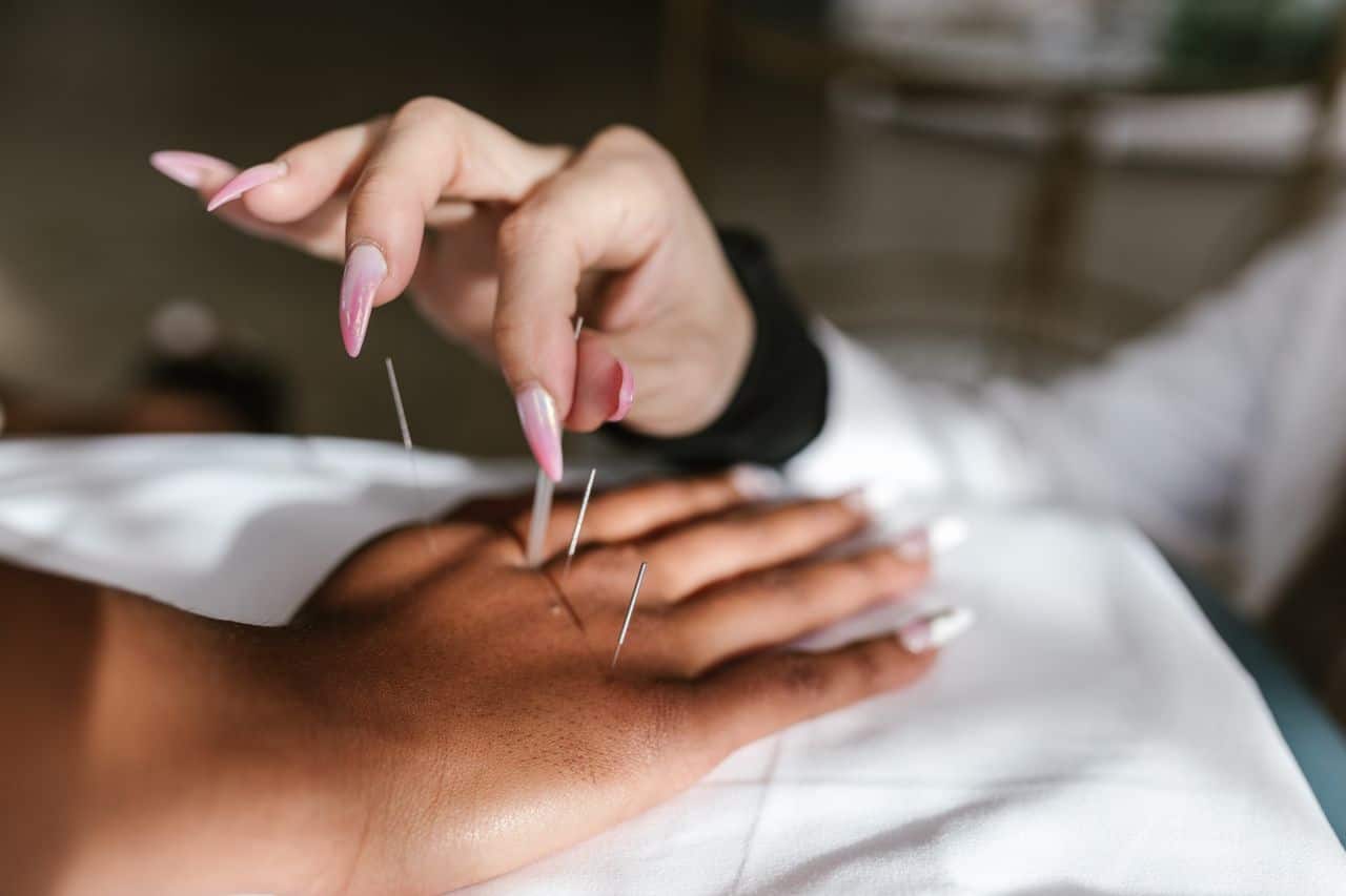 Benefits of Acupuncture Benefits of Acupuncture